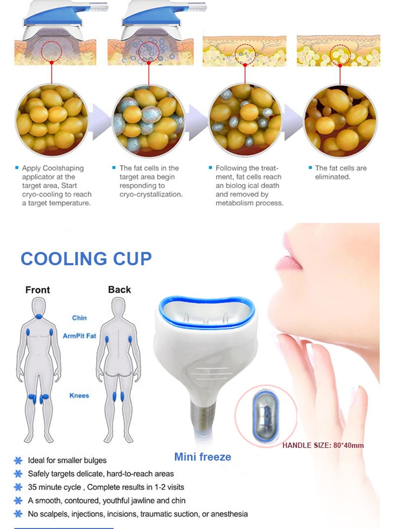 Machine Cryolipolyse professionnels